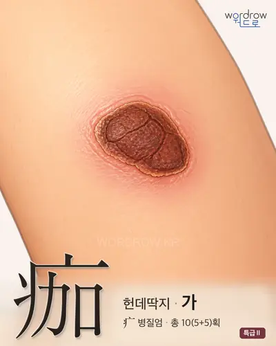 痂 (헌데딱지 가) - 특급Ⅱ 썸네일