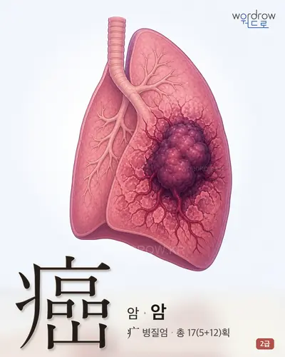 癌 (암) - 2급 썸네일